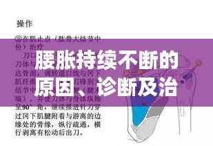 腰胀持续不断的原因、诊断及治疗方法解析