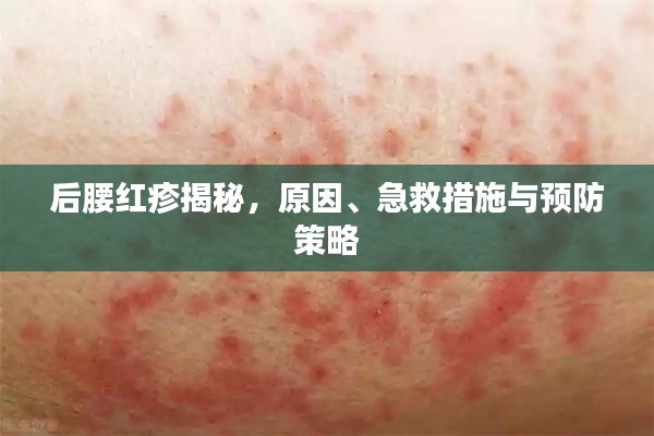 后腰红疹揭秘,原因、急救措施与预防策略