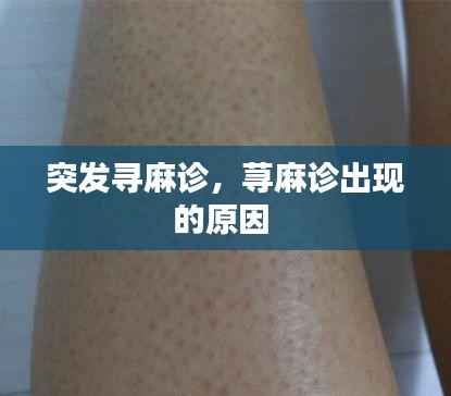 突发寻麻诊，荨麻诊出现的原因 