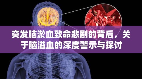 突发脑淤血致命悲剧的背后,关于脑溢血的深度警示与探讨